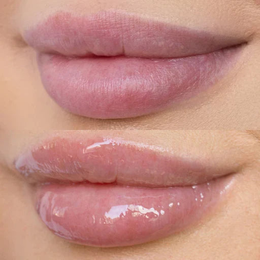 High Shine Hydrating Lip Oil - Toi Beauty High Shine Hydrating Lip Oil - Toi Beauty lips