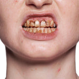 KRYOLAN Tooth Enamel