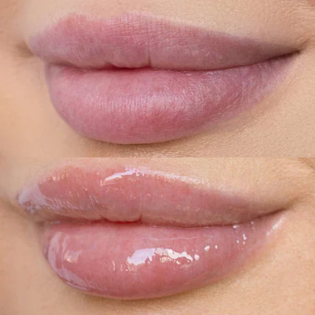 High Shine Hydrating Lip Oil - Toi Beauty High Shine Hydrating Lip Oil - Toi Beauty lips