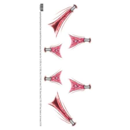 Stretched Trauma Temp Tattoo