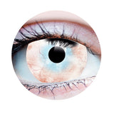 Plague Contact LENSES- Mini Sclera