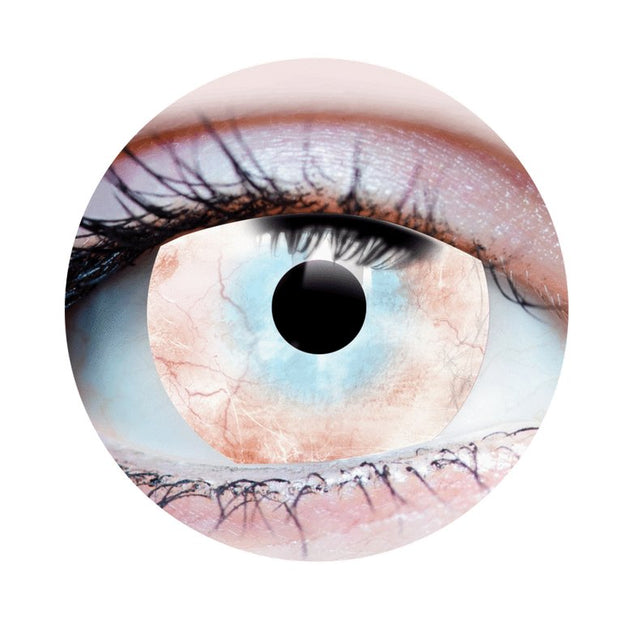 Plague Contact LENSES- Mini Sclera